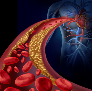 Cholesterol Understanding the Basics and its Impact on Health